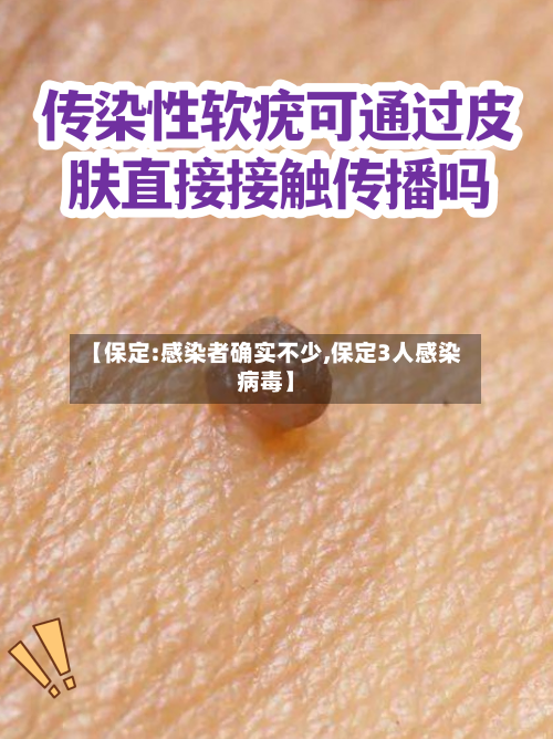 【保定:感染者确实不少,保定3人感染病毒】