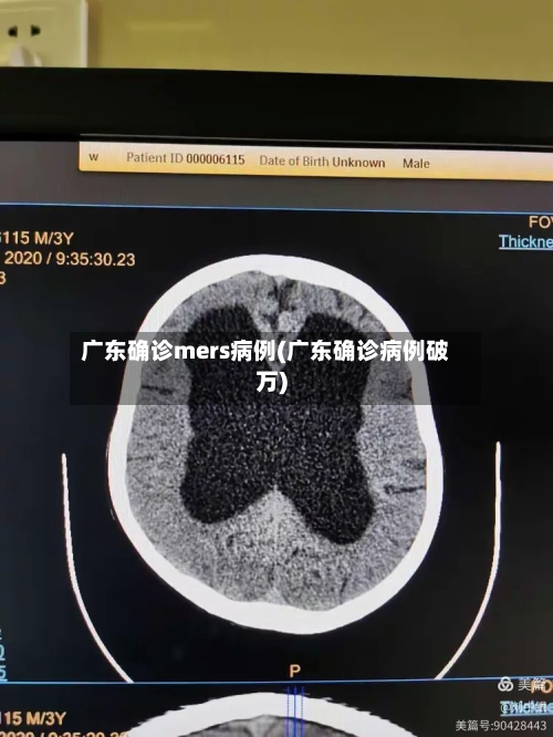 广东确诊mers病例(广东确诊病例破万)