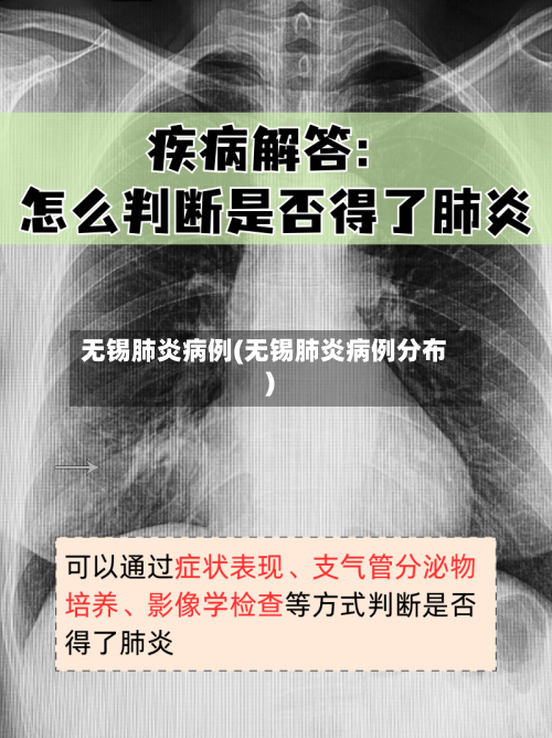 无锡肺炎病例(无锡肺炎病例分布)-第2张图片